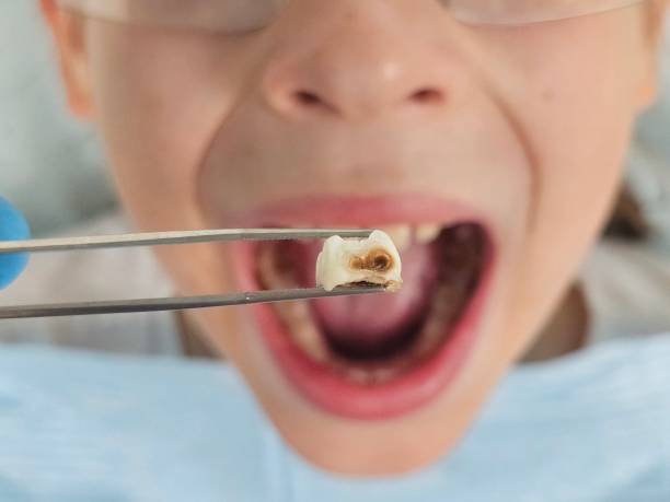Best Pediatric Emergency Dentist in Brooklyn, NY